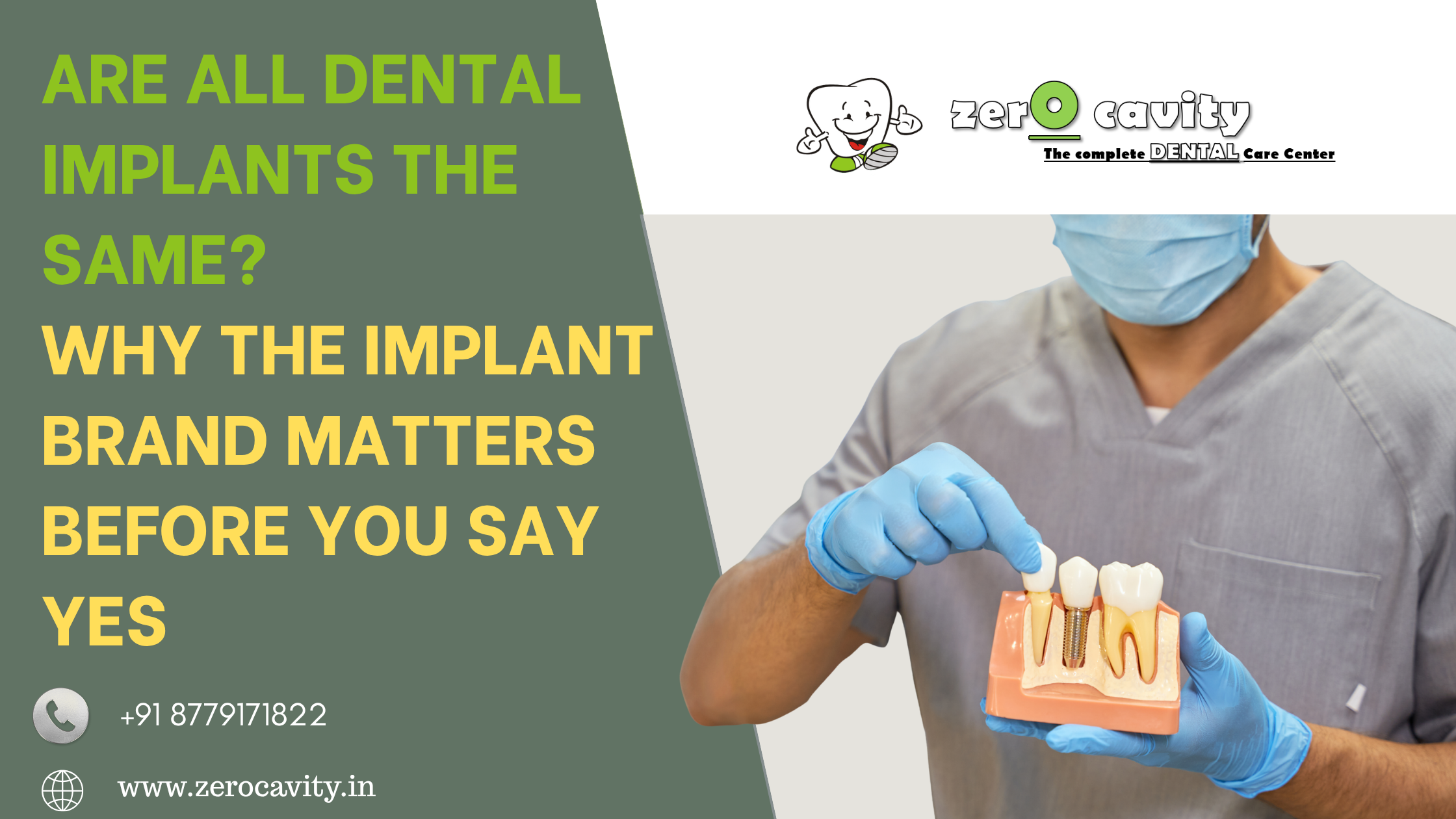 Are All Dental Implants the Same? Why the Implant Brand Matters Before You Say Yes