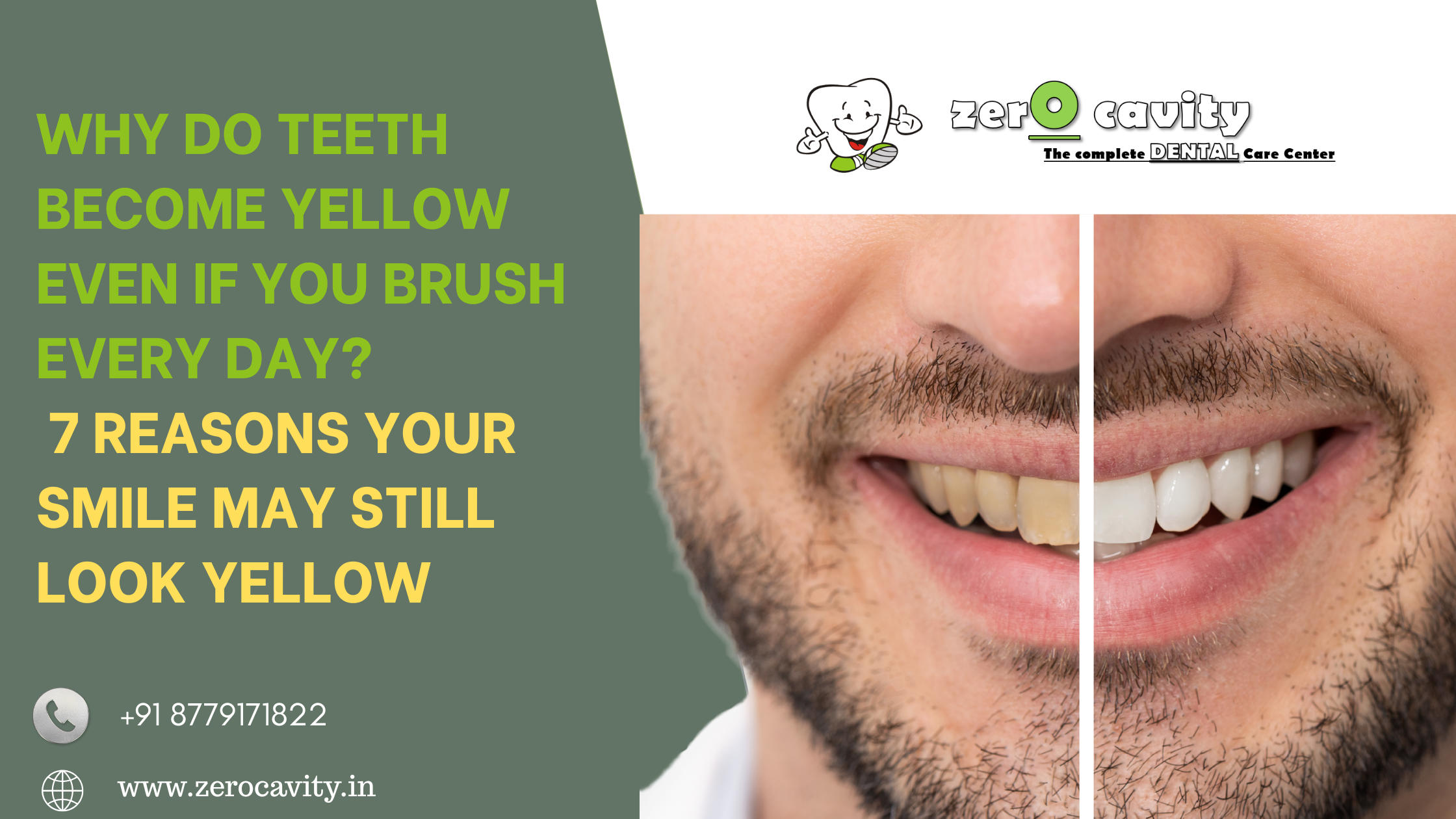 Why Do Teeth Become Yellow Even If You Brush Every Day? 7 Reasons Your Smile May Still Look Yellow